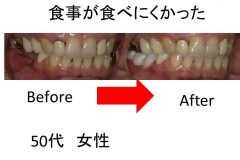 食事が食べにくい