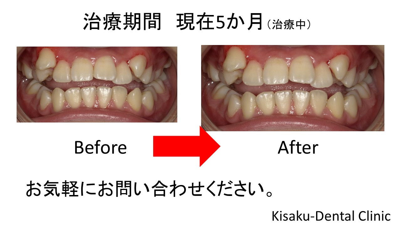 高品質の人気 矯正歯科治療の基本と類似症例が必ず見つかる!ラーニング