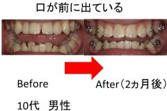 口が飛び出している