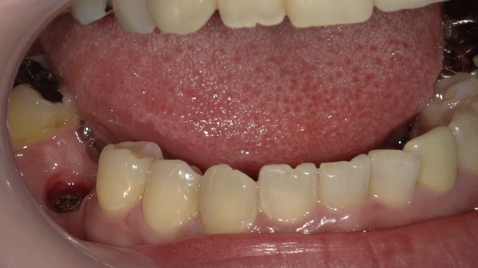 Before image