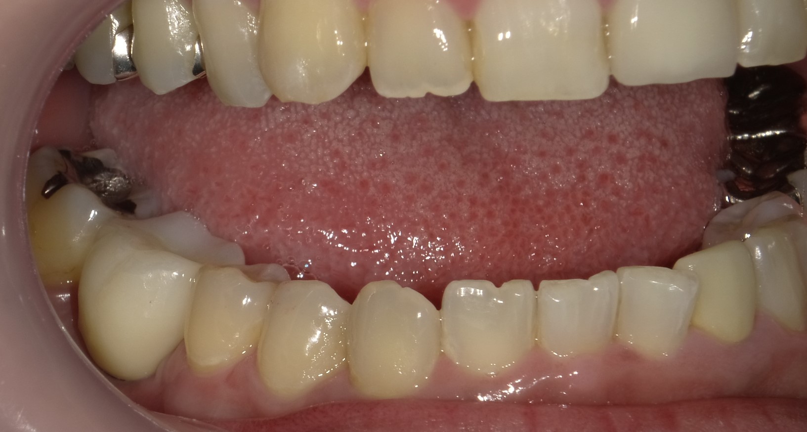 After image