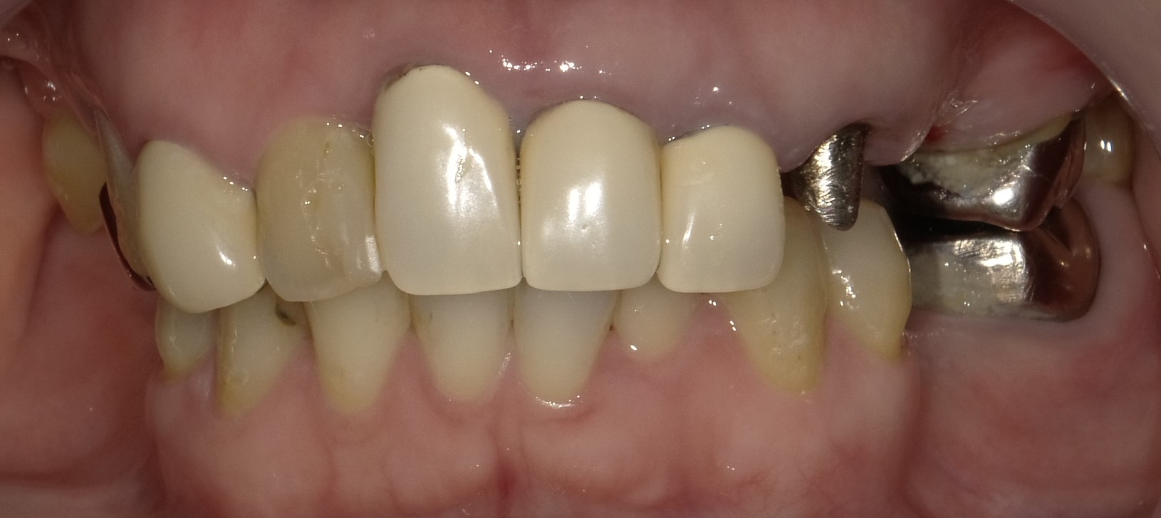 Before image