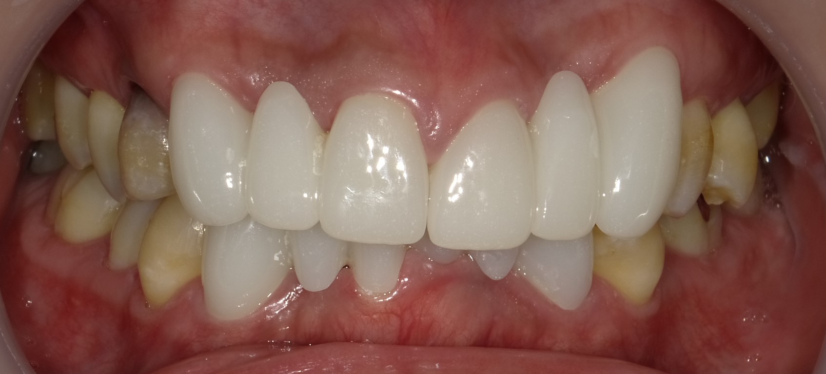 After image