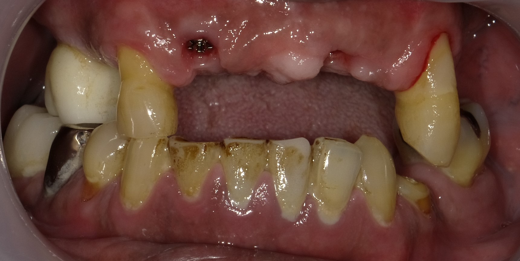 Before image