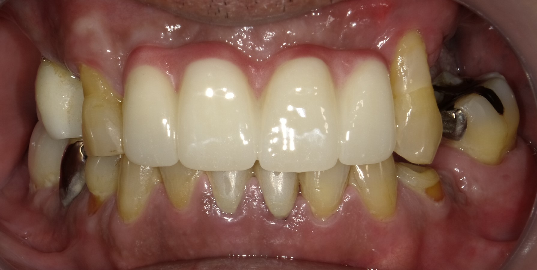 After image