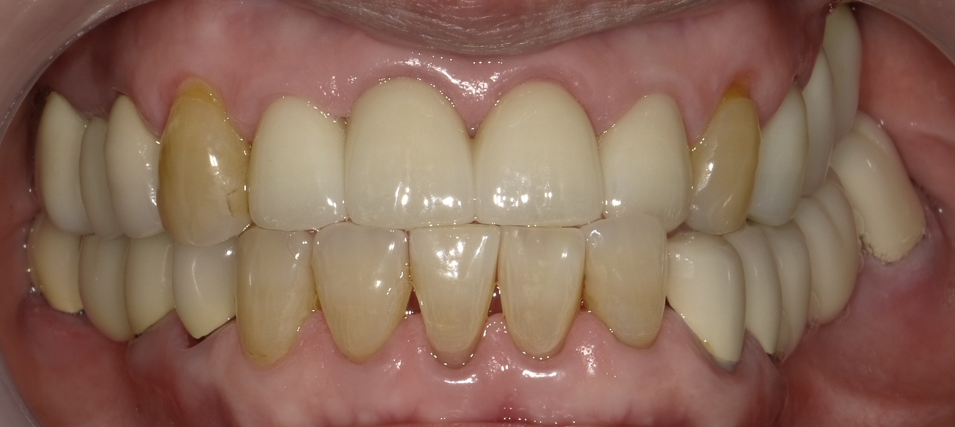 Before image