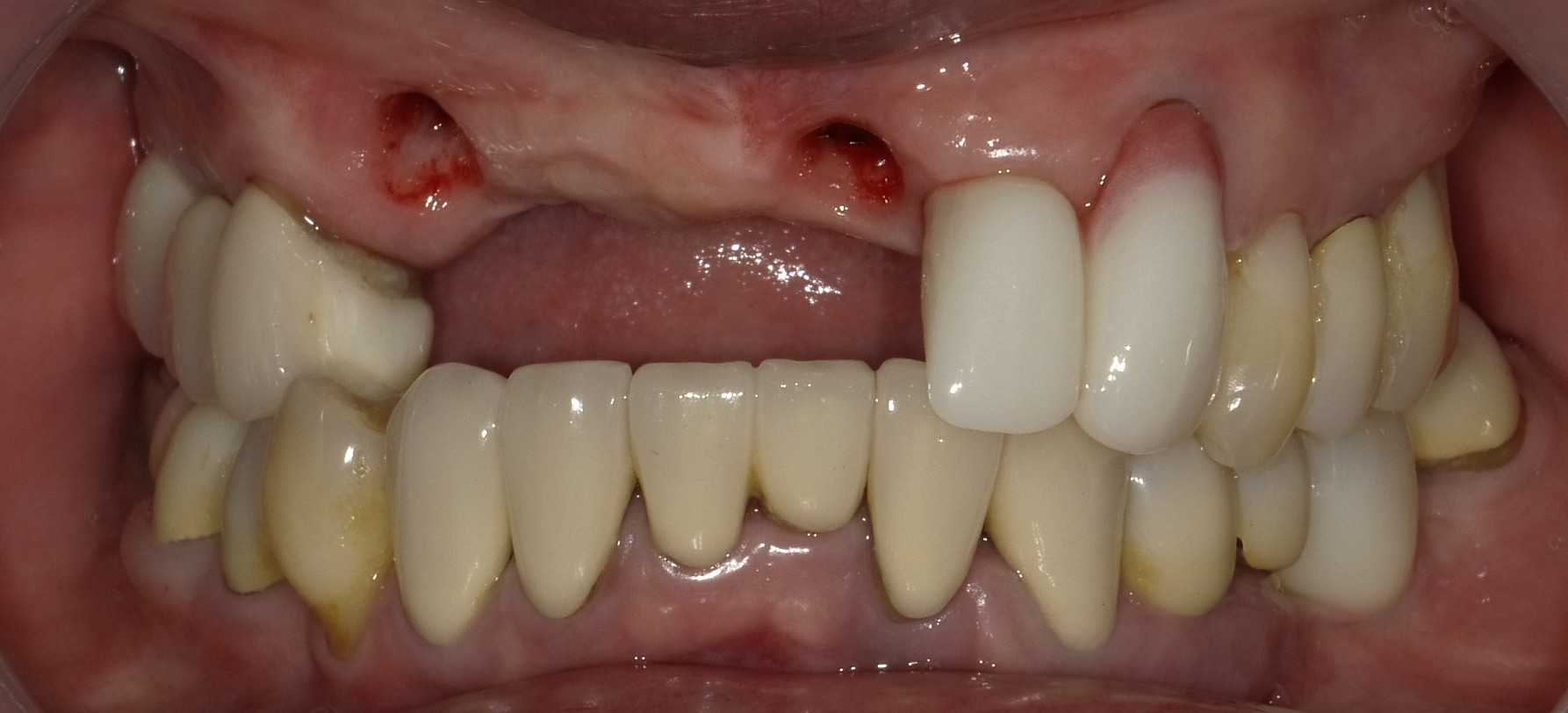 Before image