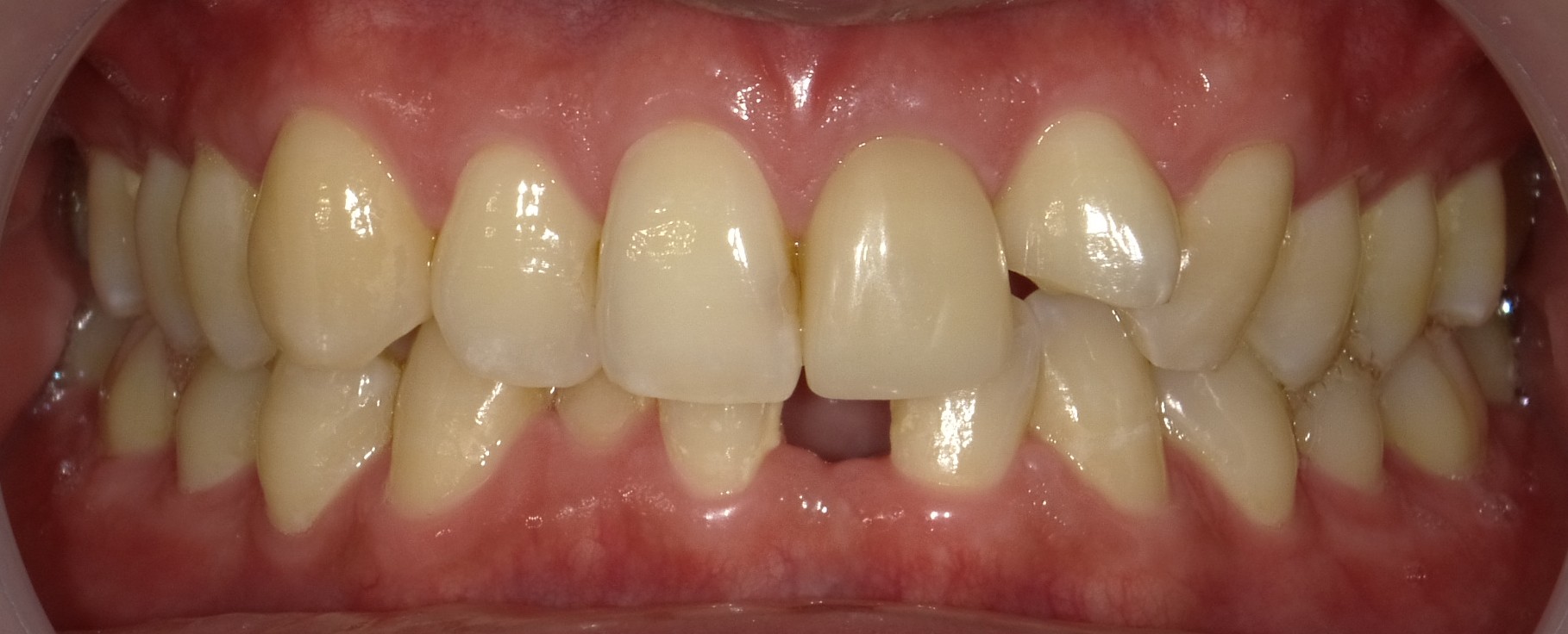 Before image