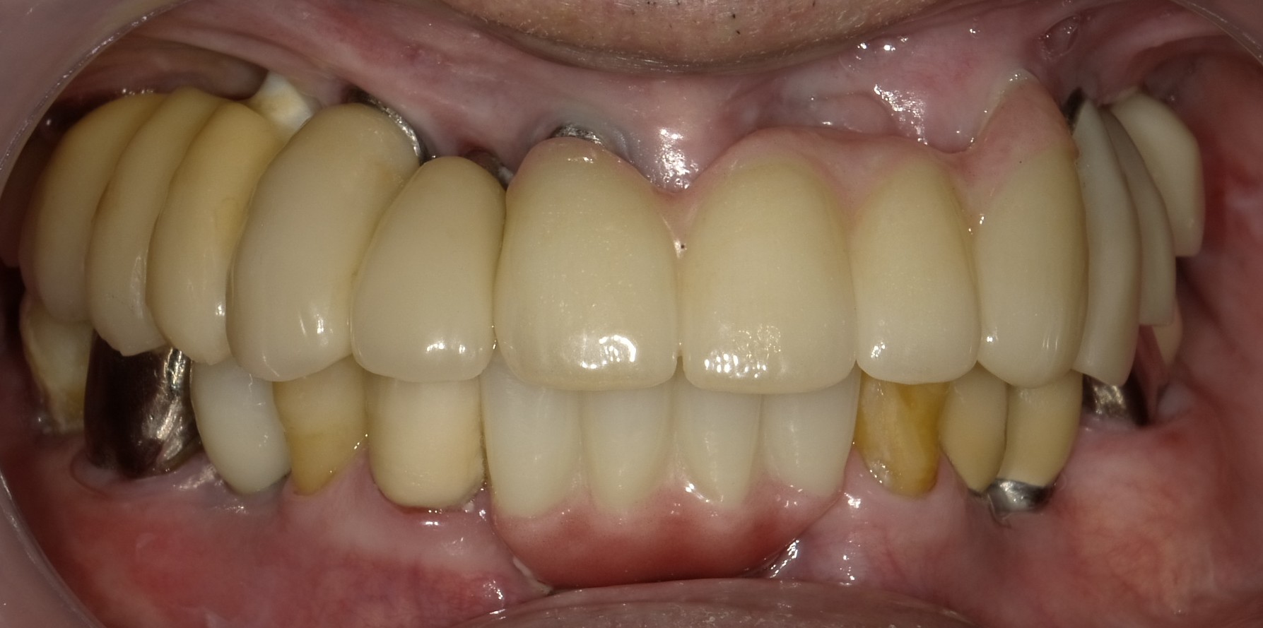 After image