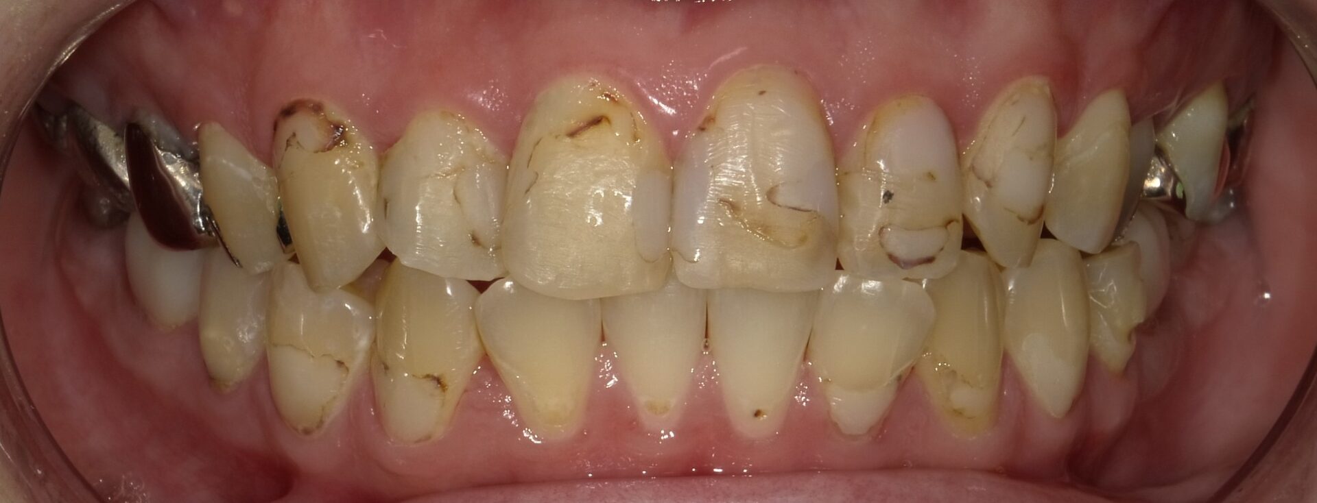 Before image