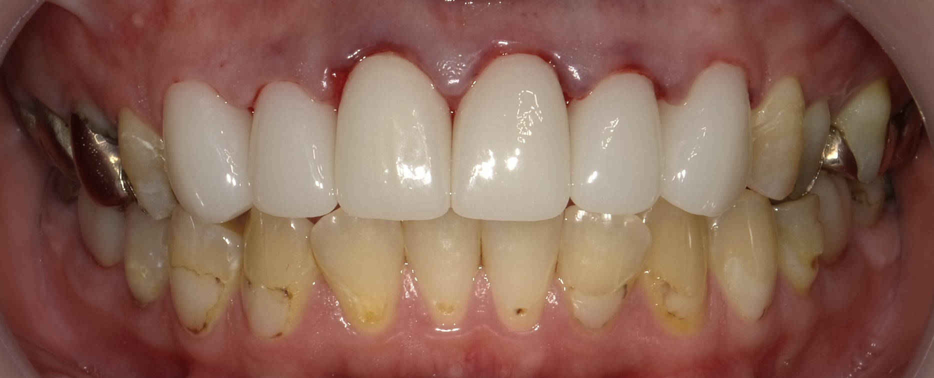 After image