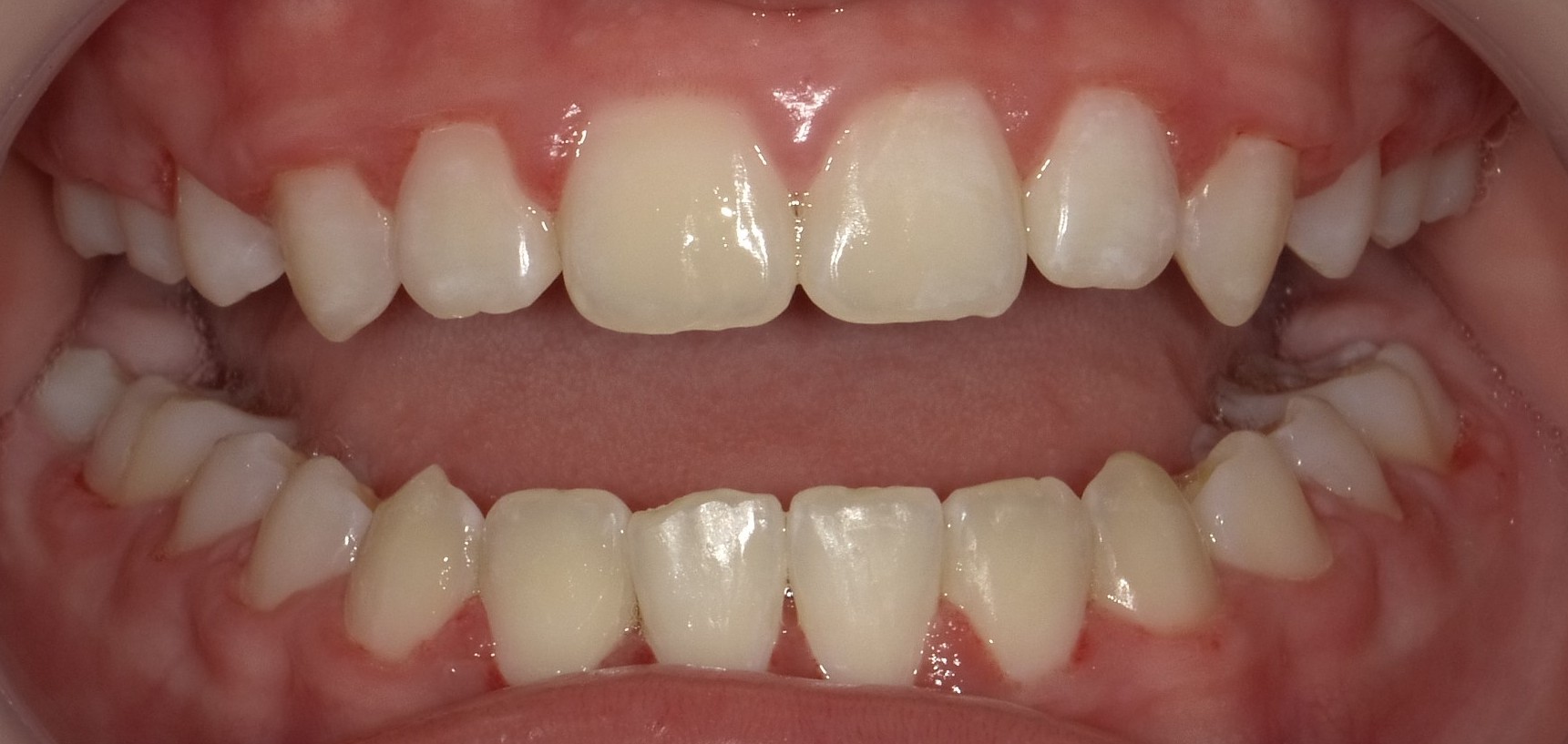 Before image