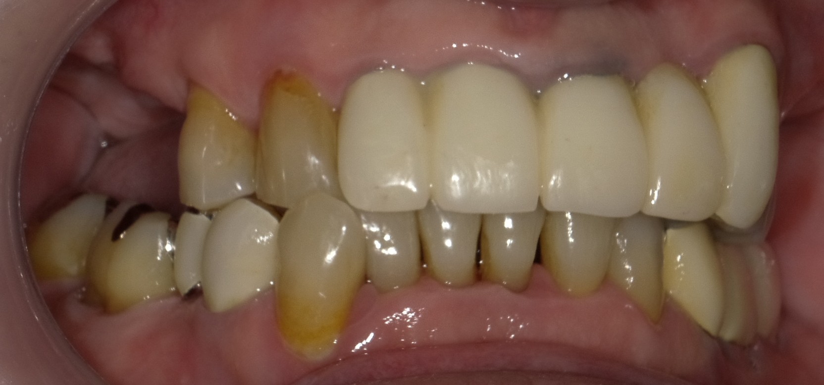 Before image