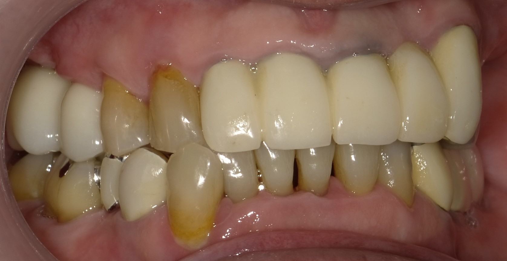 After image