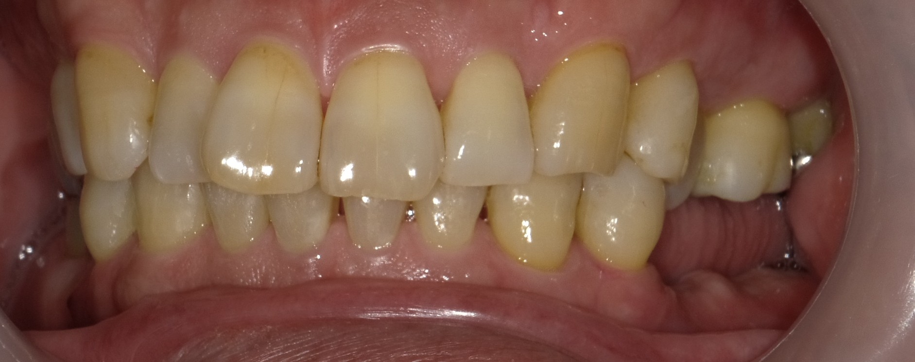 Before image
