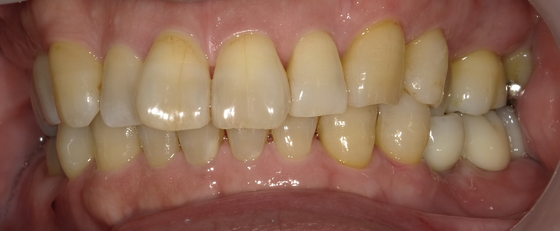 After image