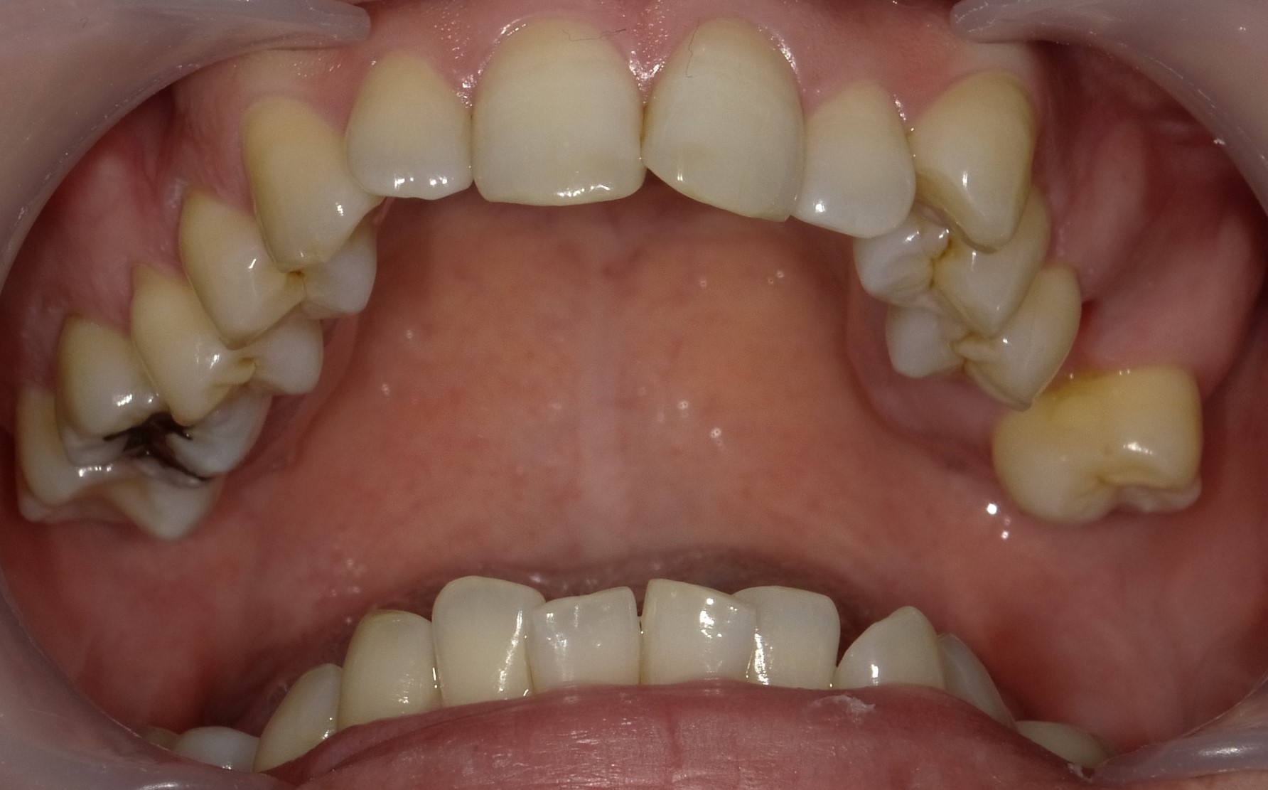 Before image