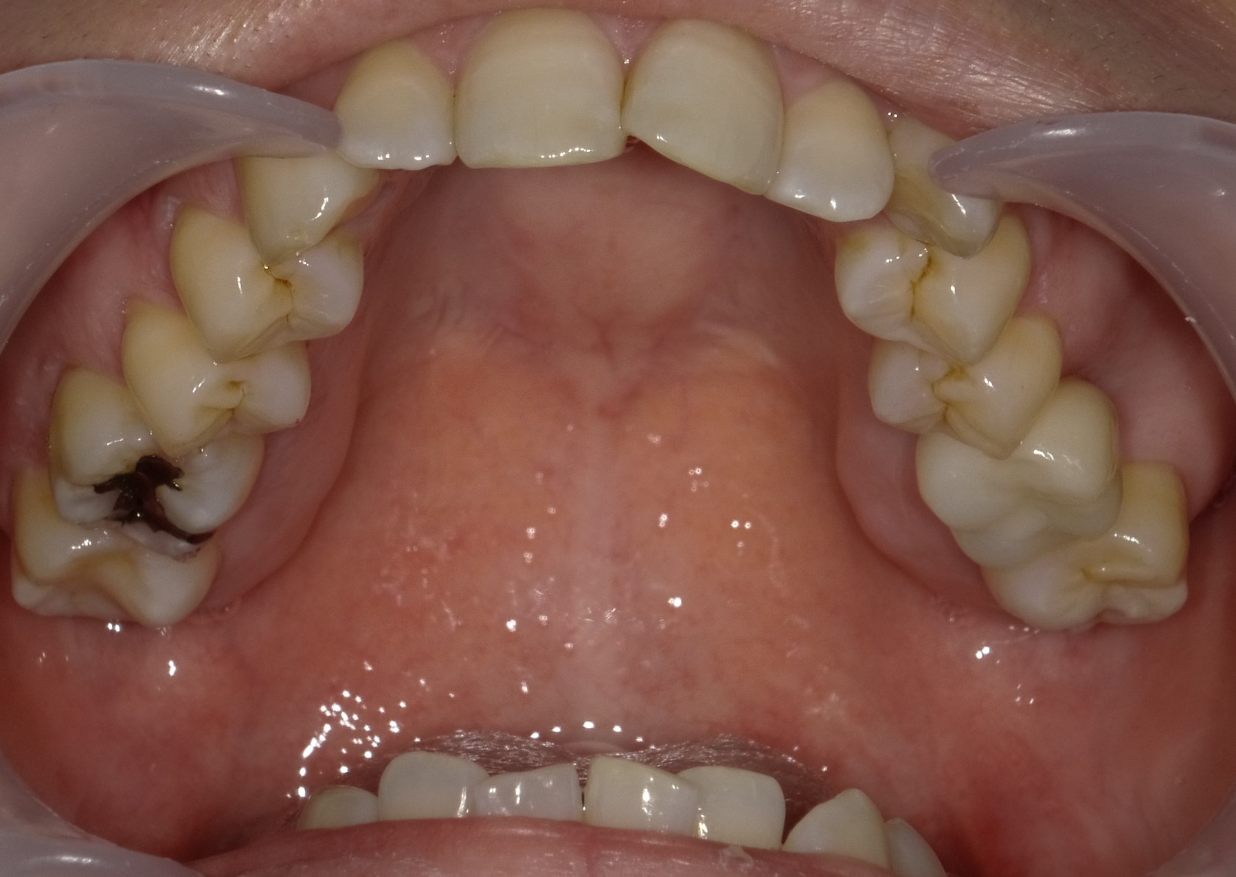 After image