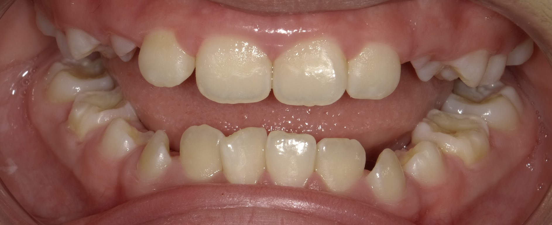 After image