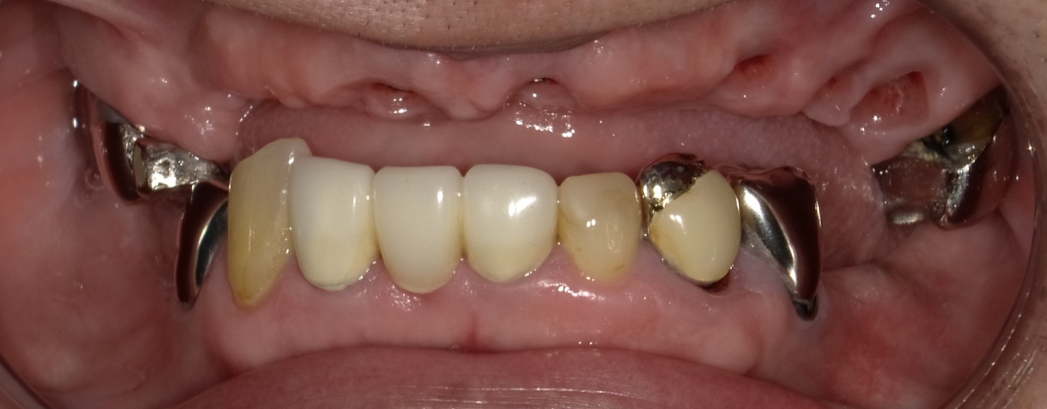 Before image
