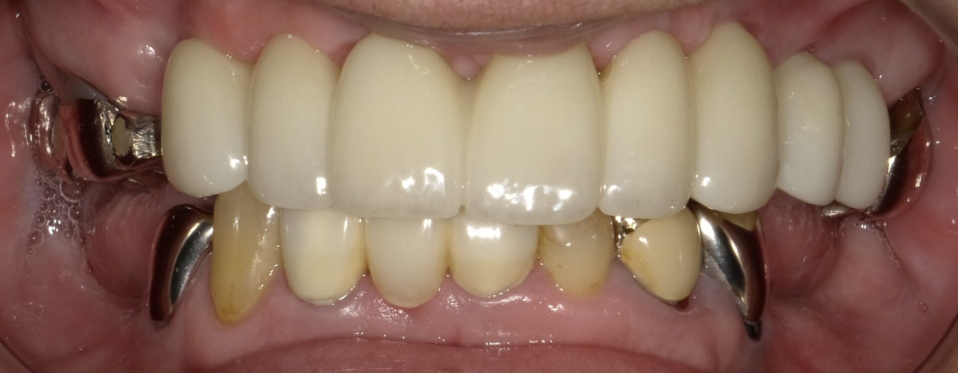 After image