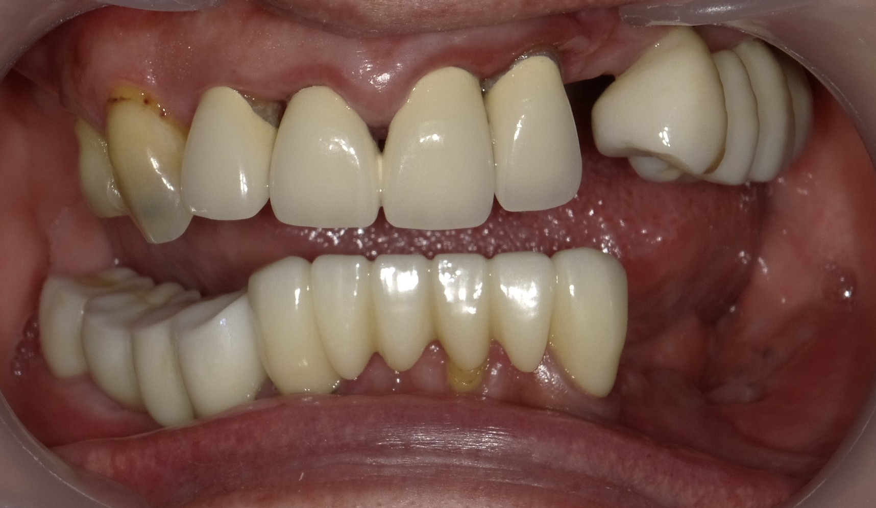Before image