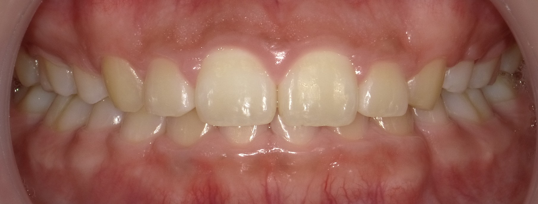 Before image