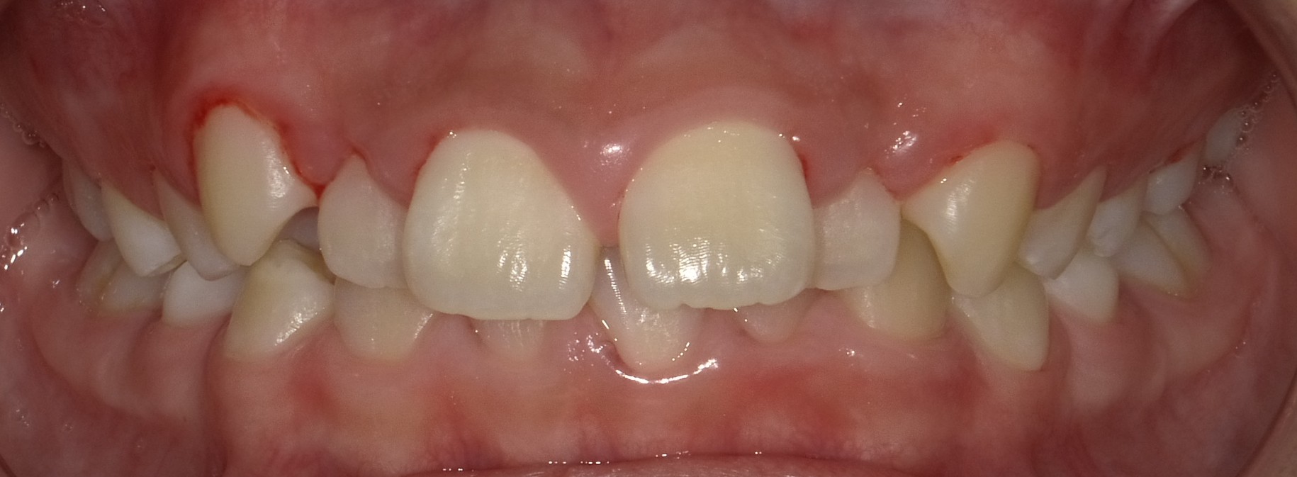 After image