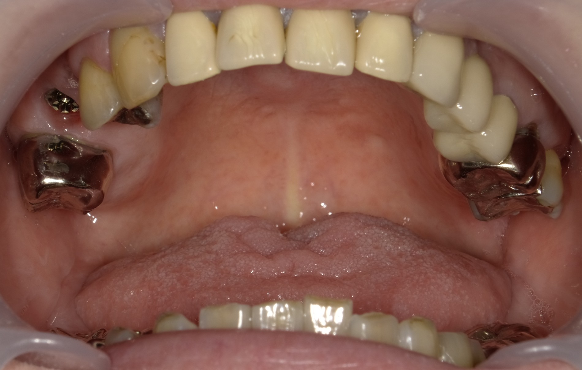 Before image