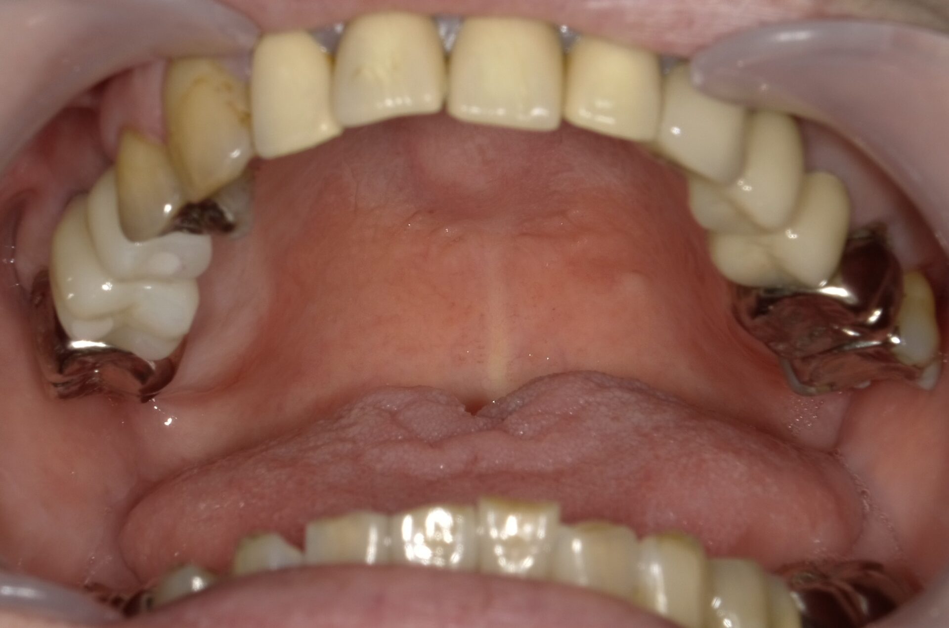 After image