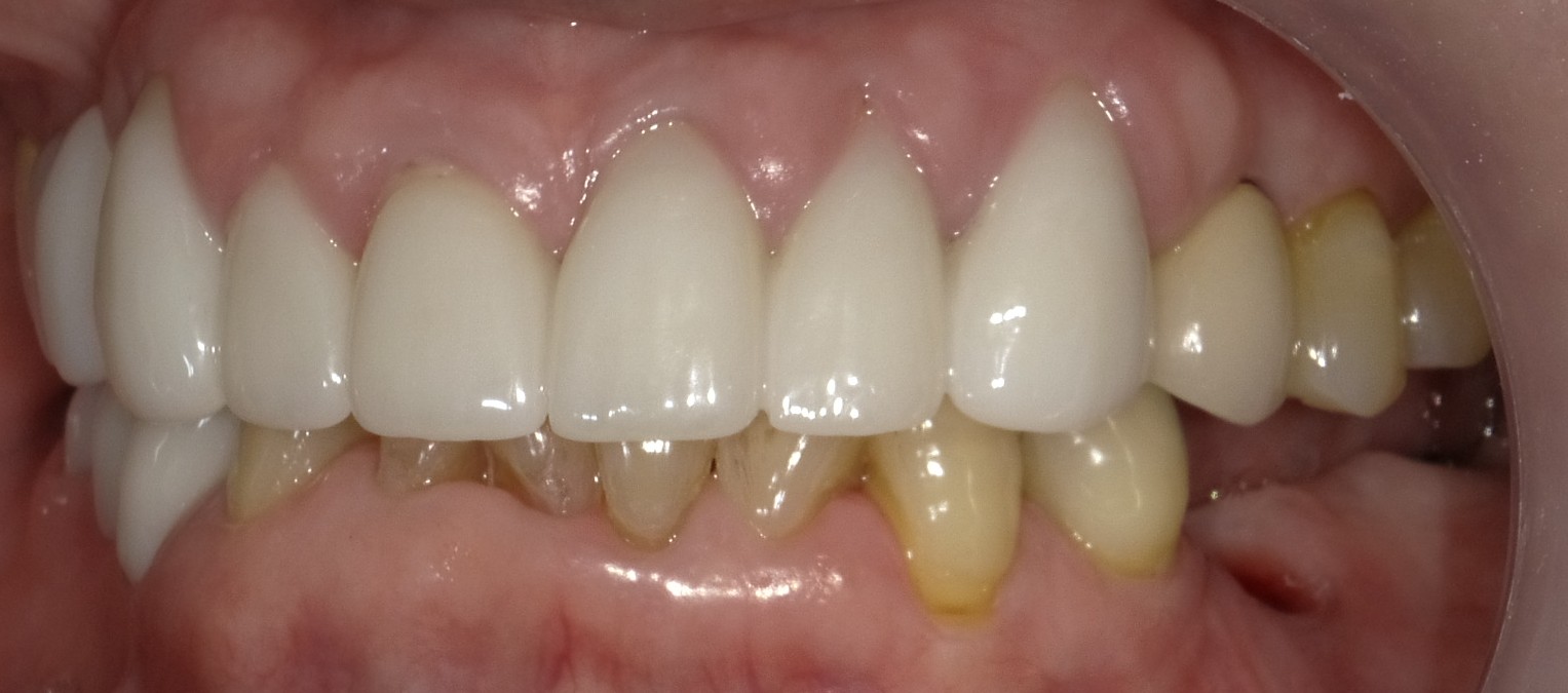 Before image