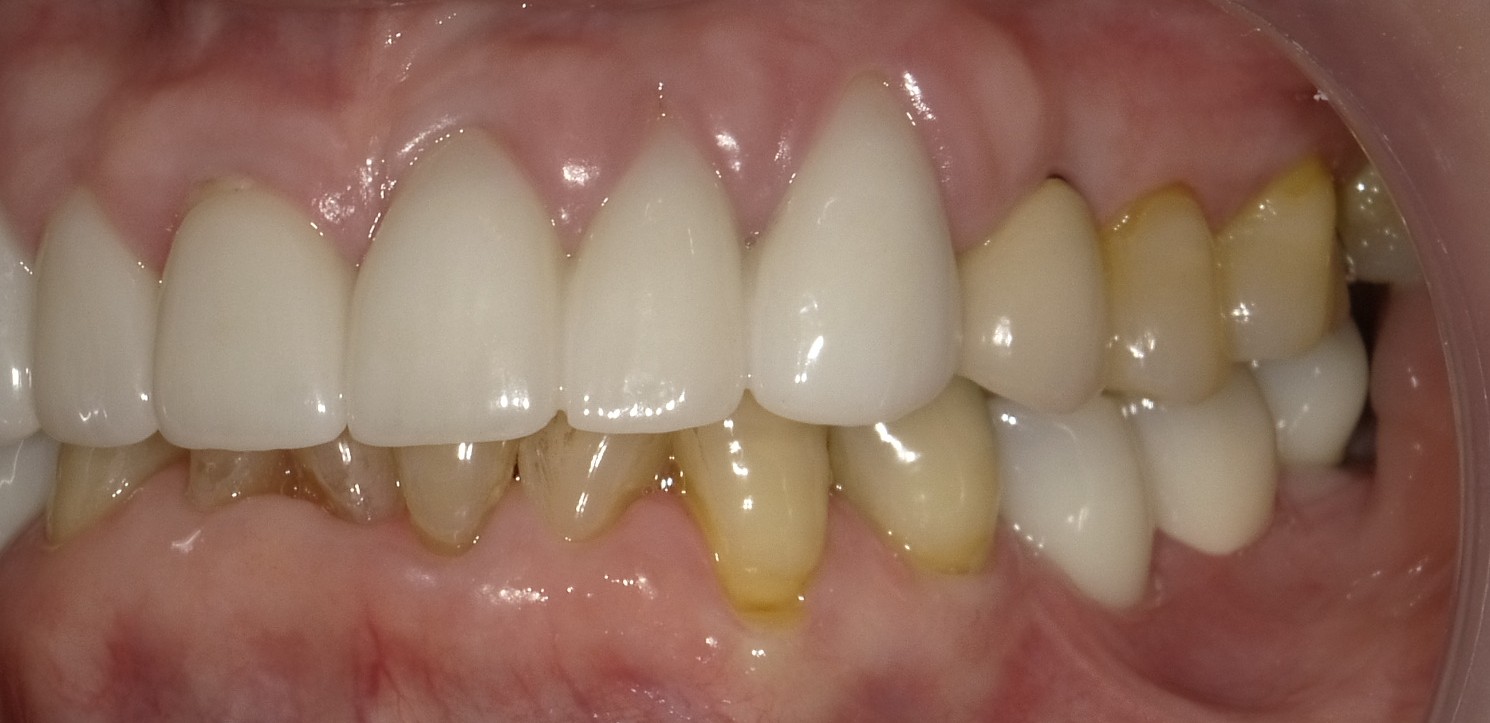 After image