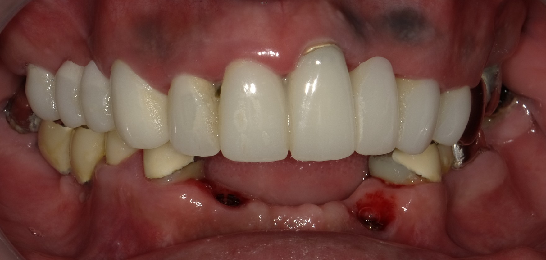 Before image