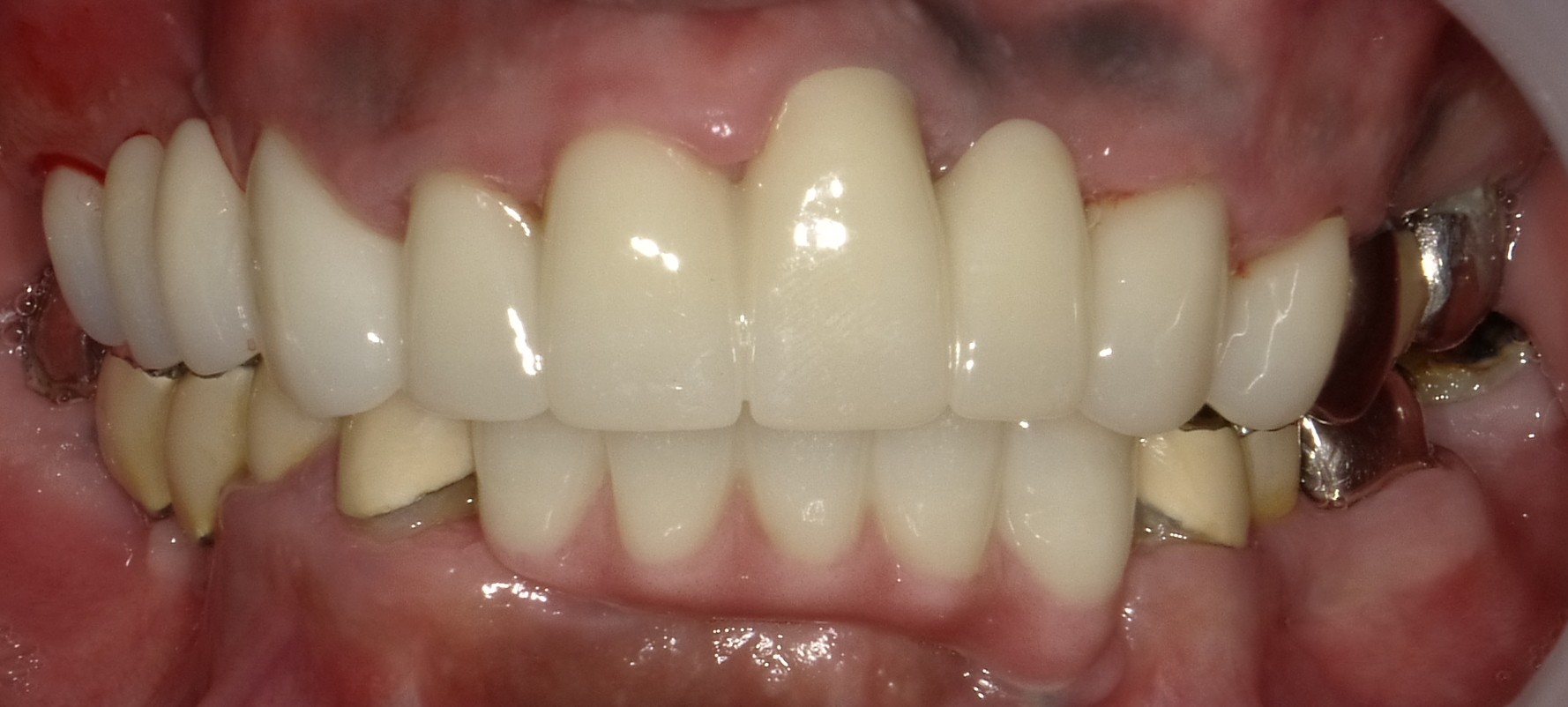 After image