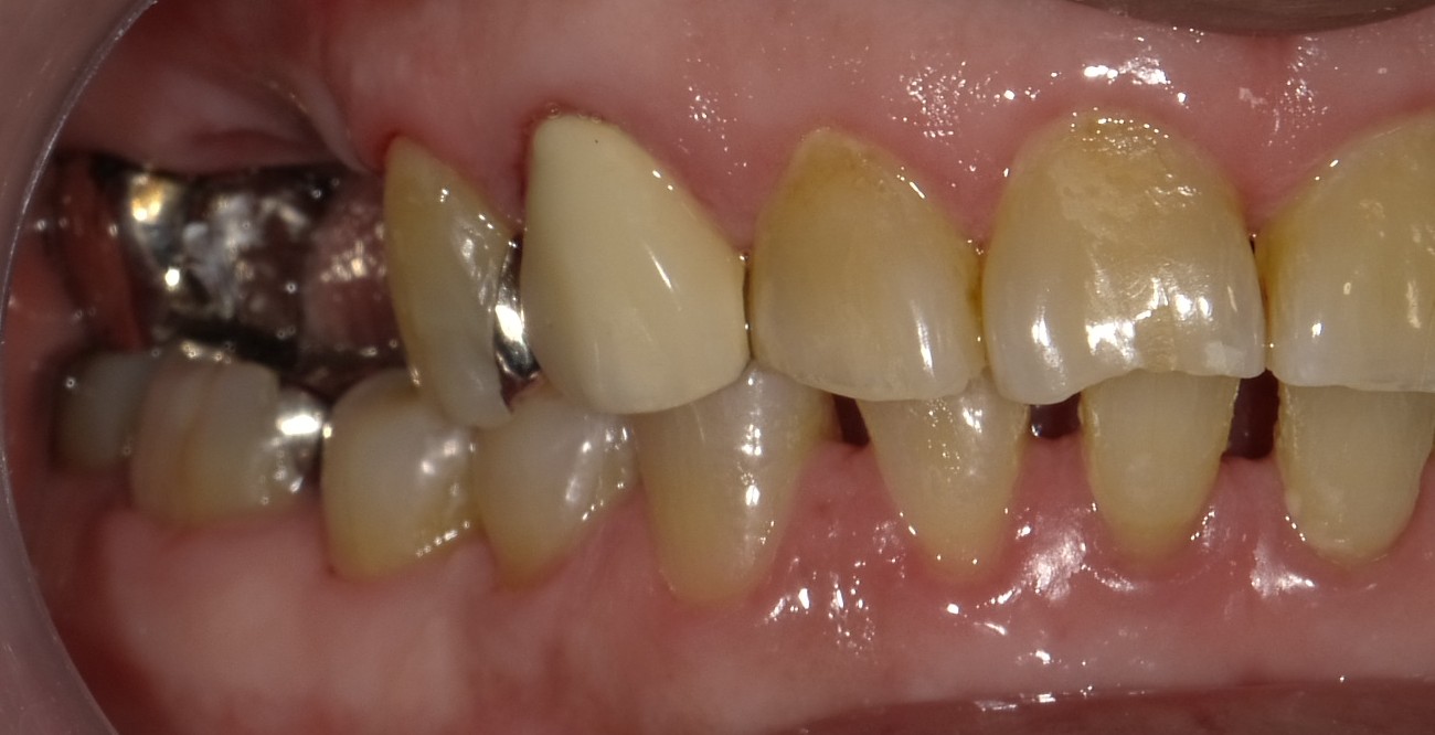 Before image