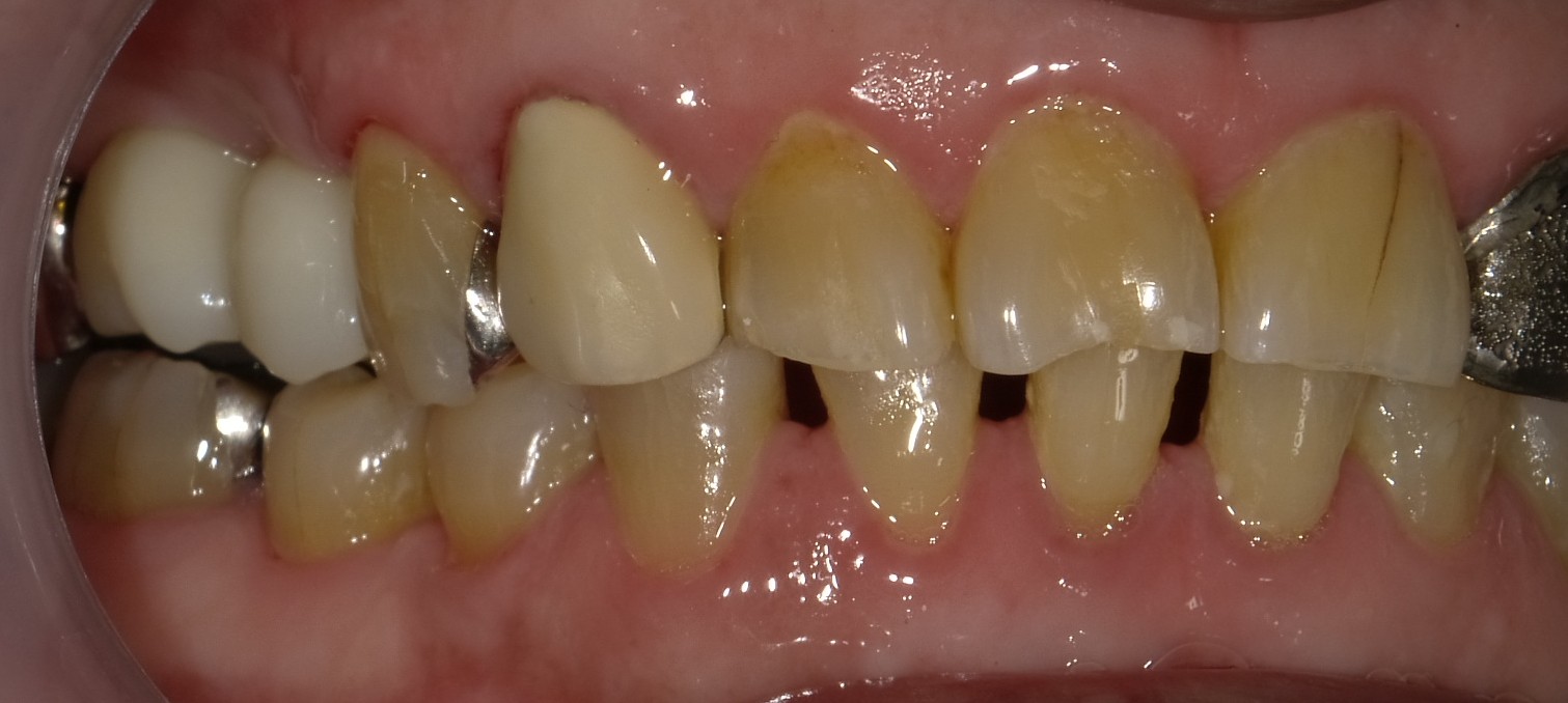 After image