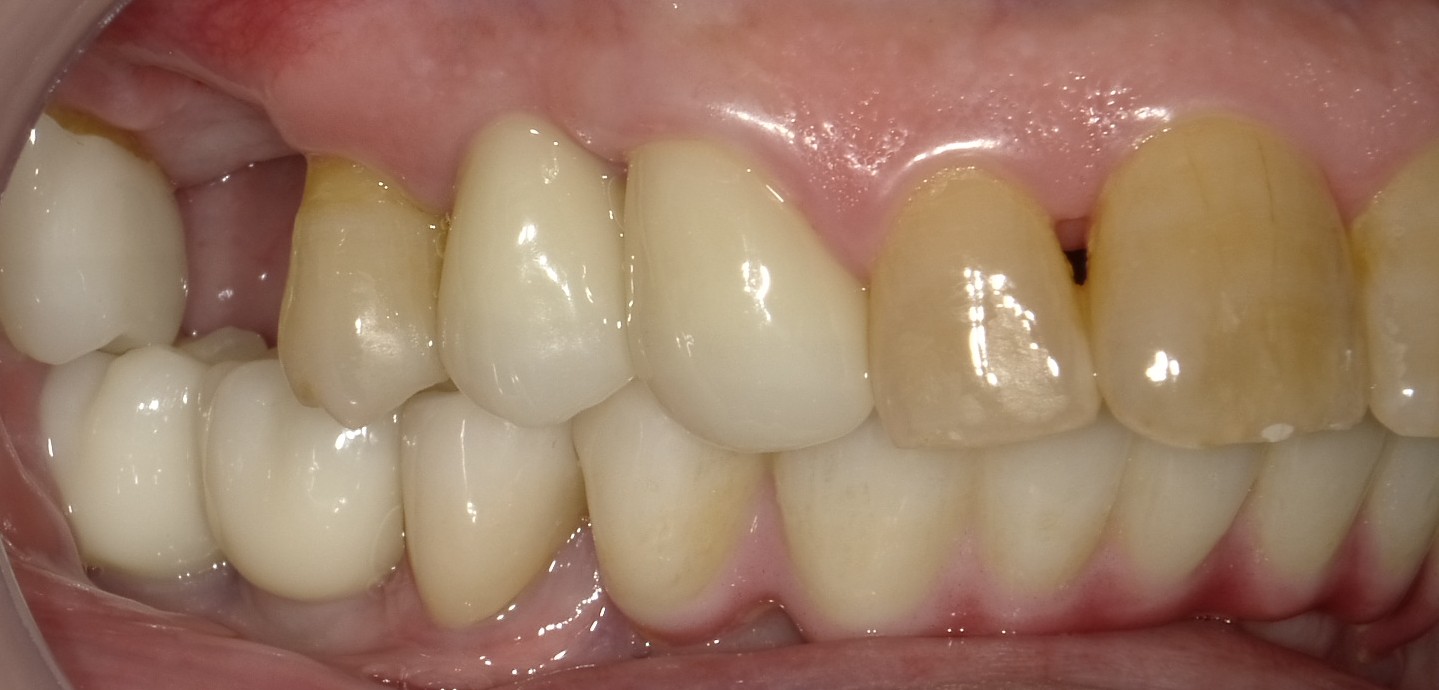 Before image