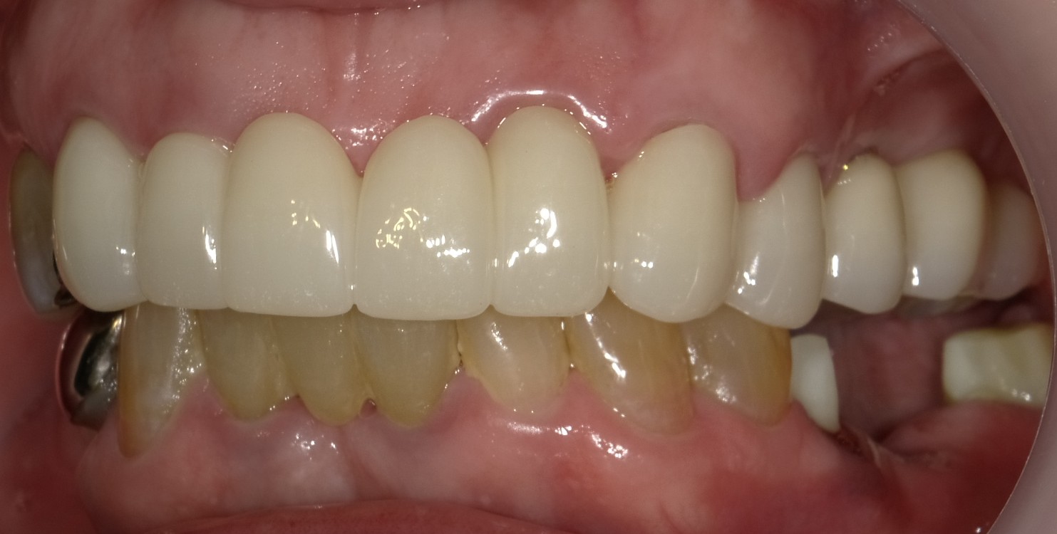 Before image