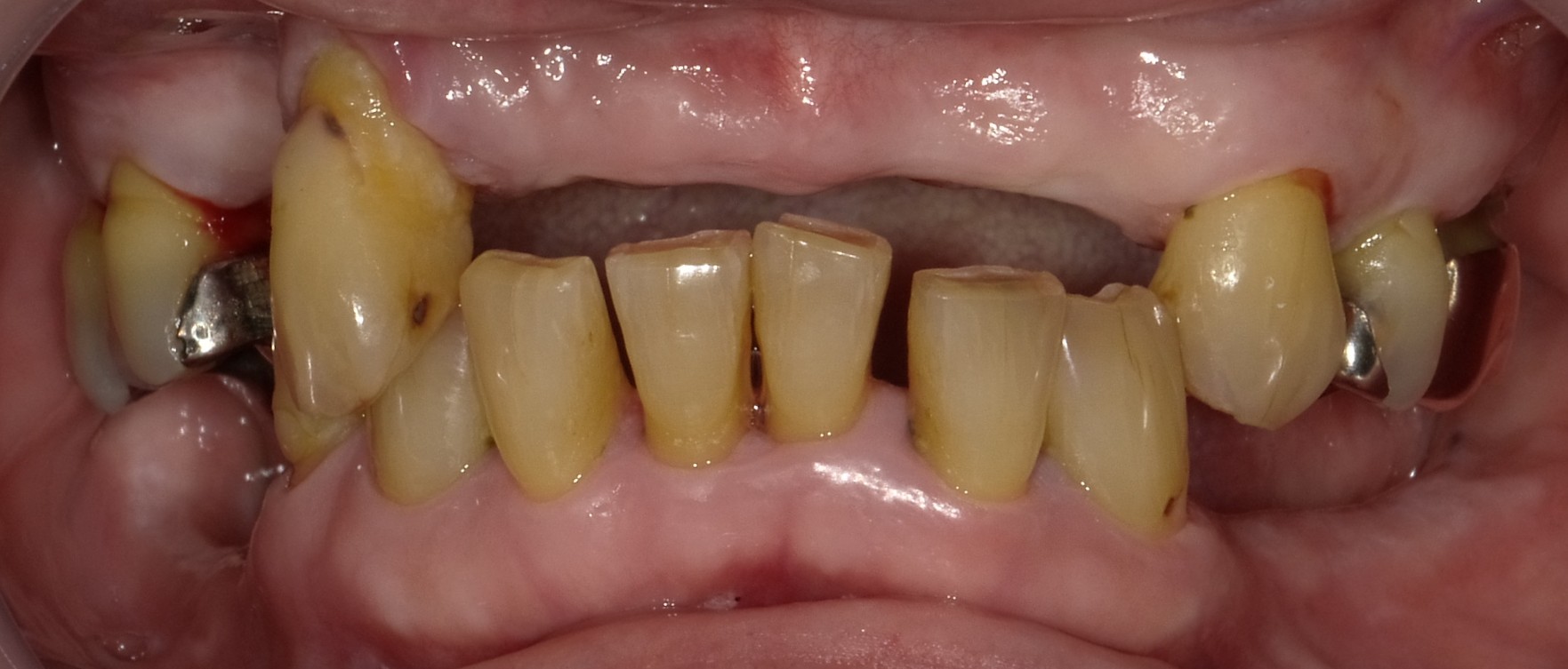 Before image