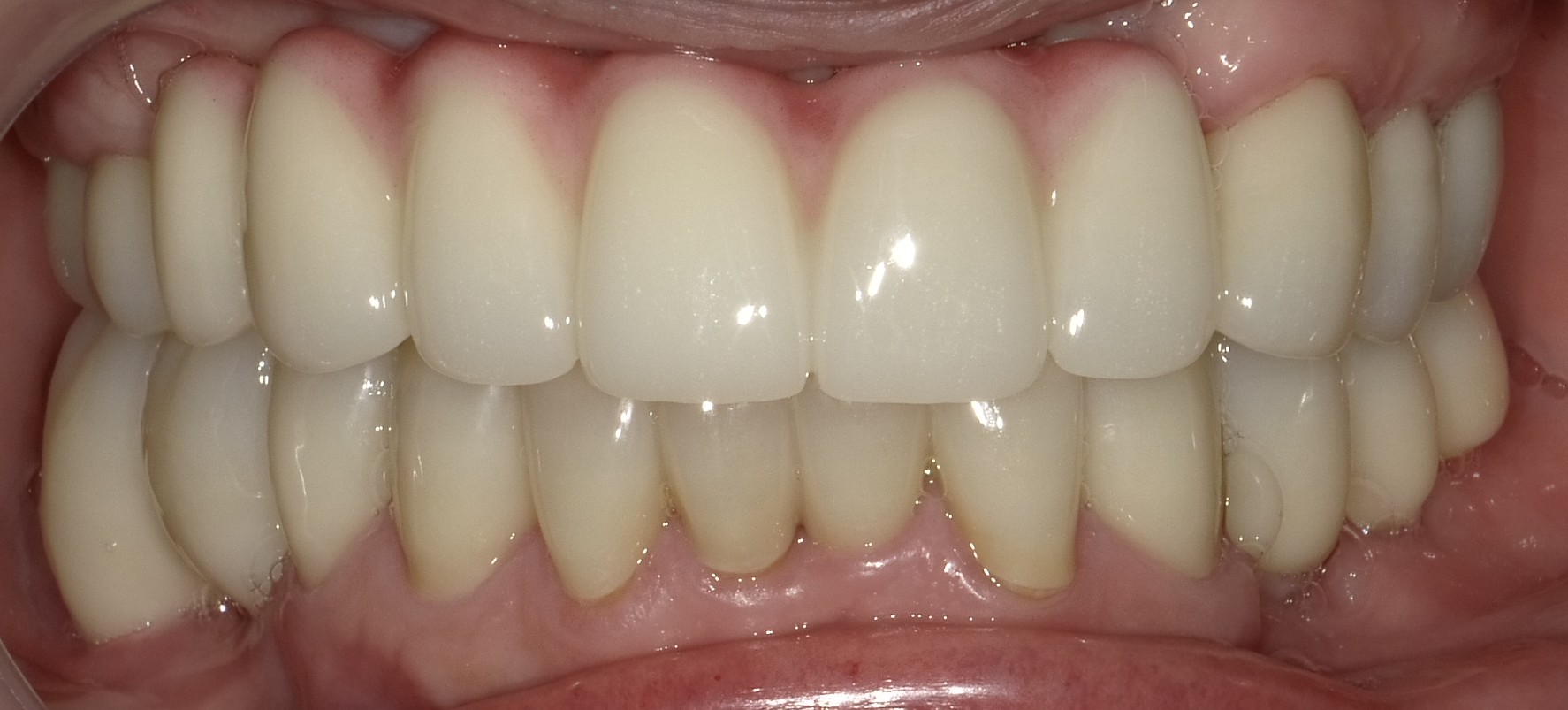 After image