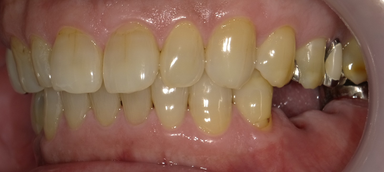 Before image