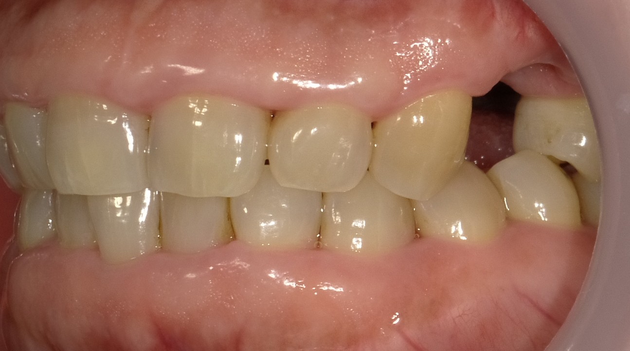Before image