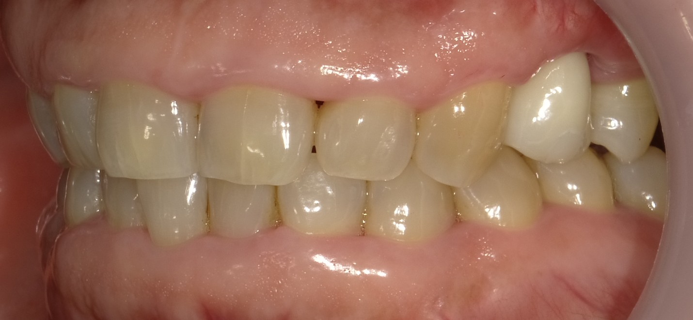 After image