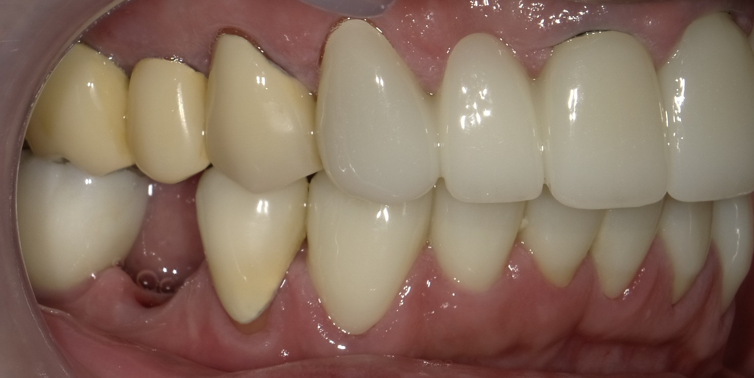 Before image