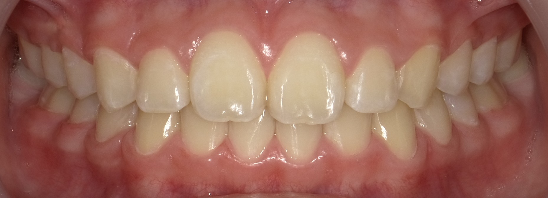 Before image