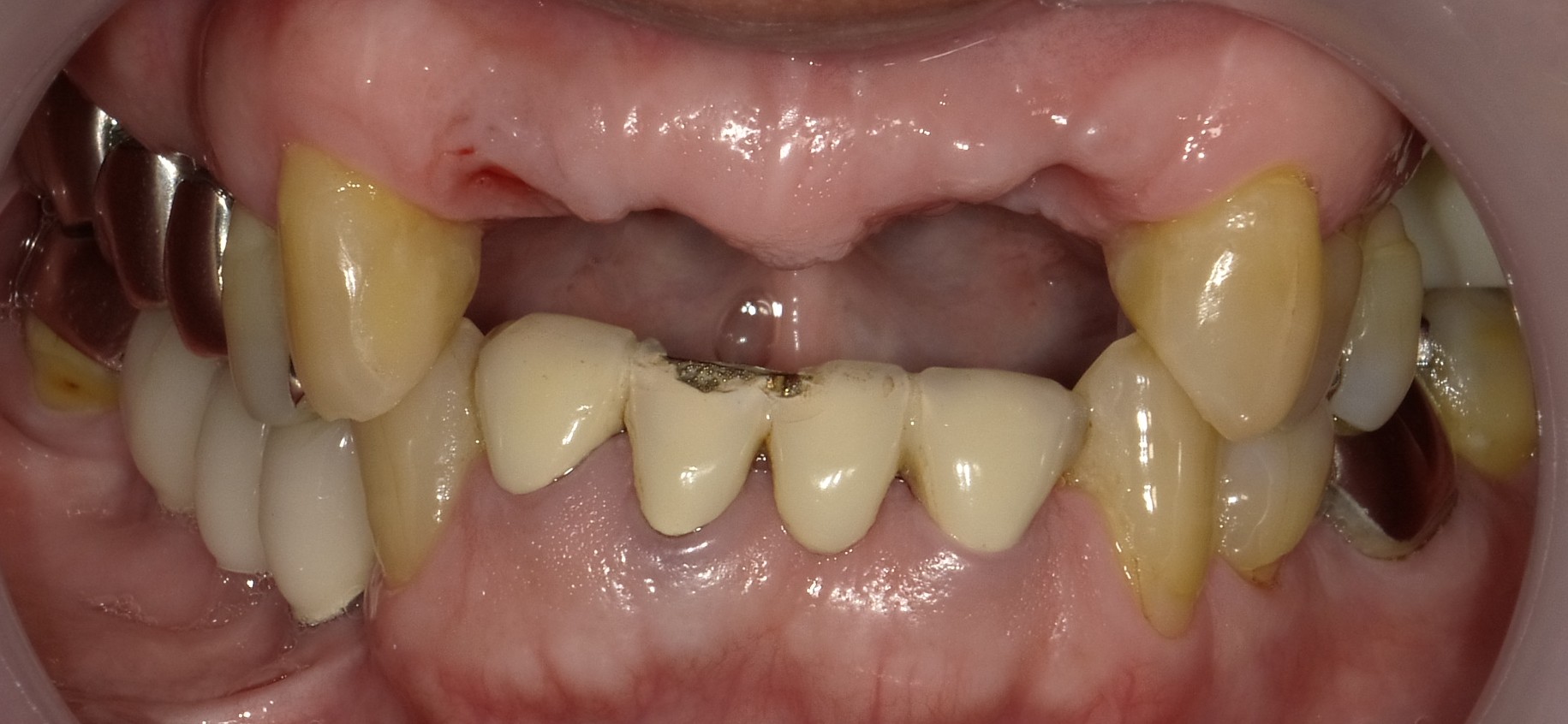 Before image