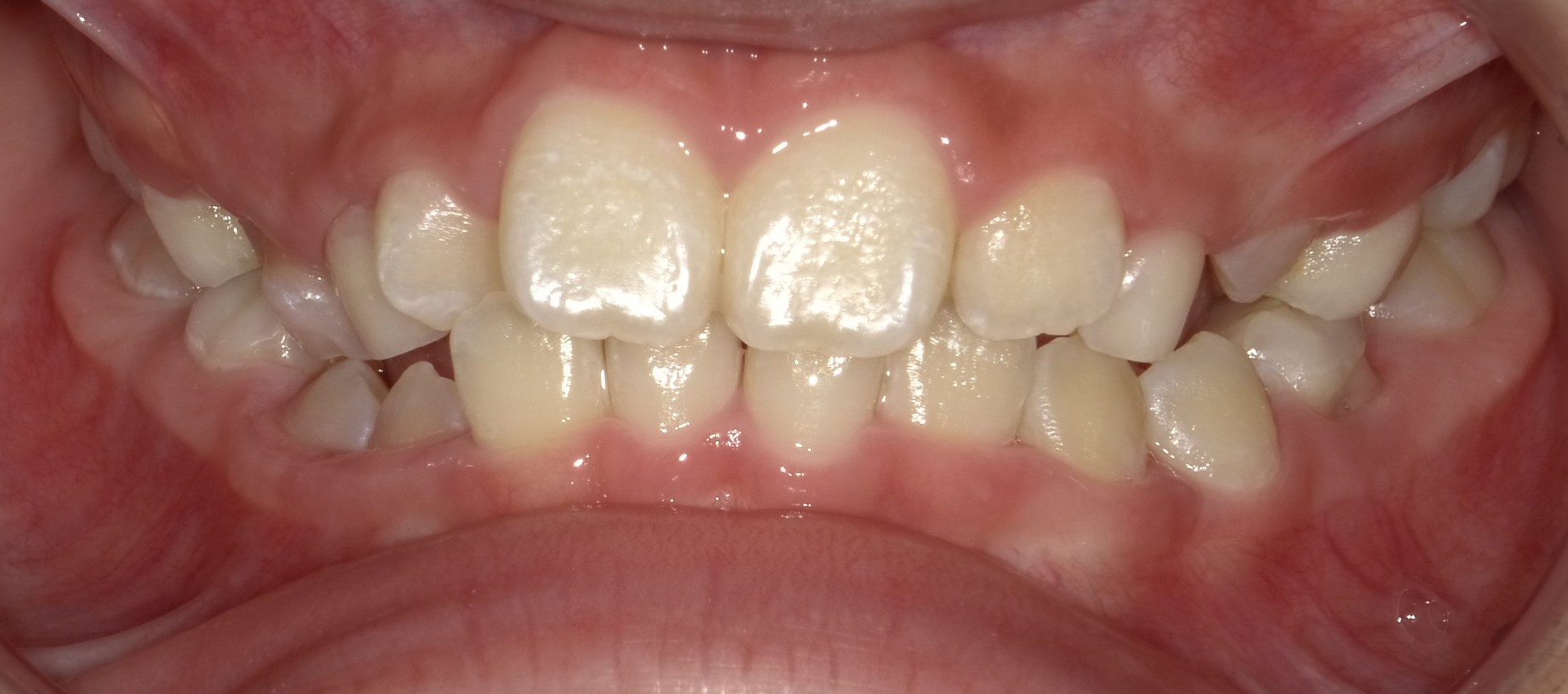 After image