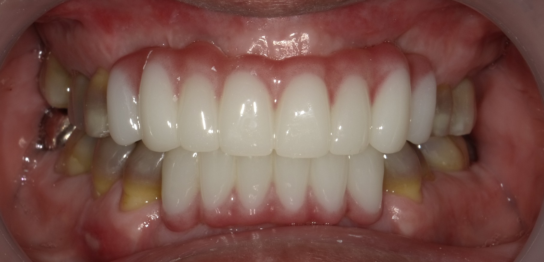 Before image