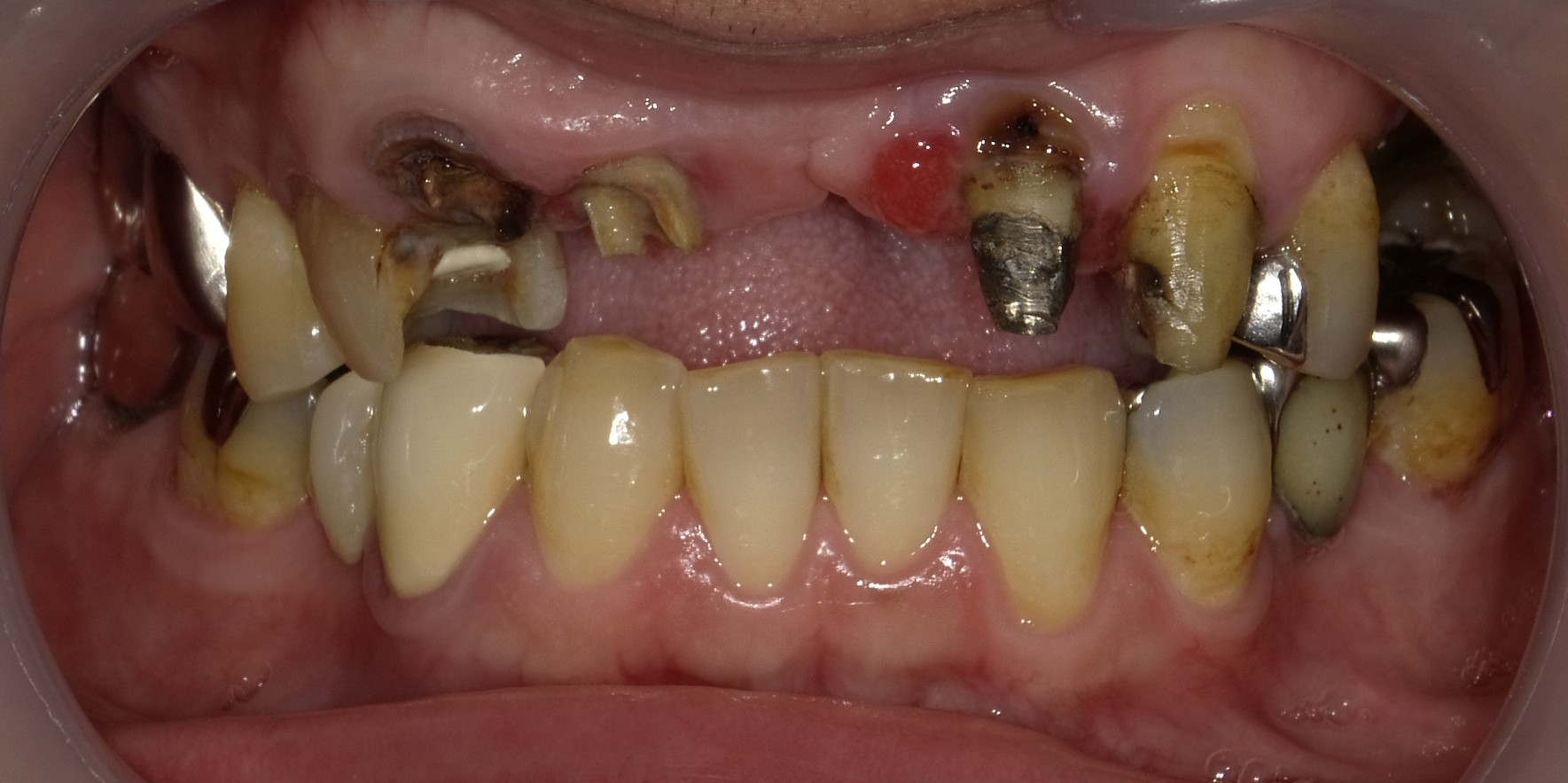 Before image