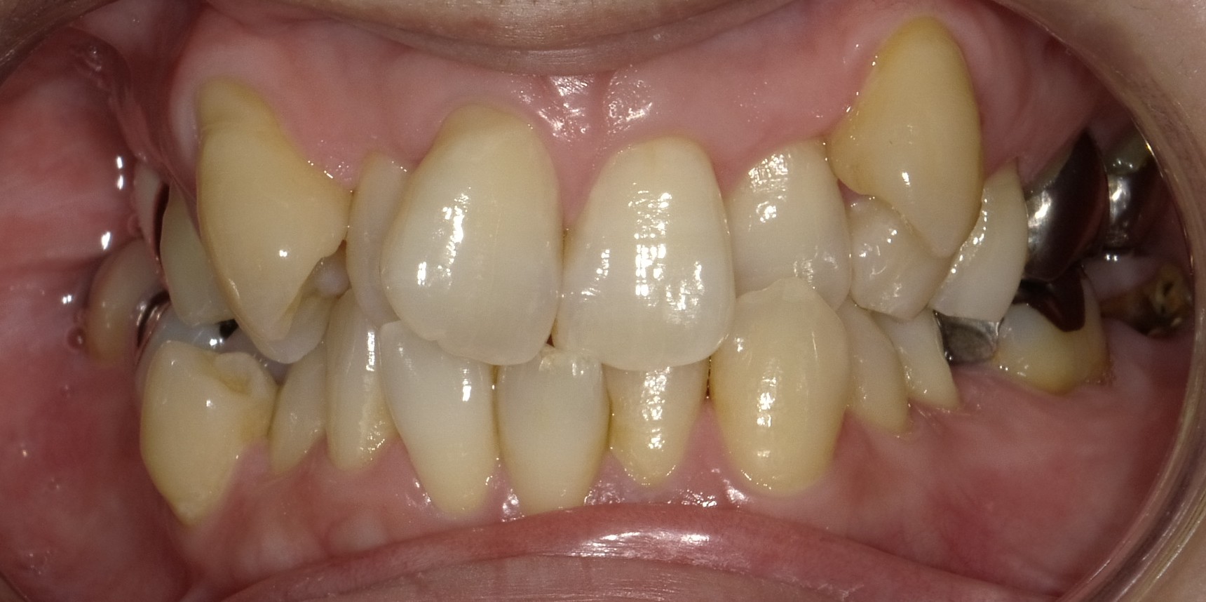 Before image